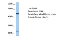 Dolichol Kinase Rabbit anti-Human, Polyclonal, Novus Biologicals 0.1ml;